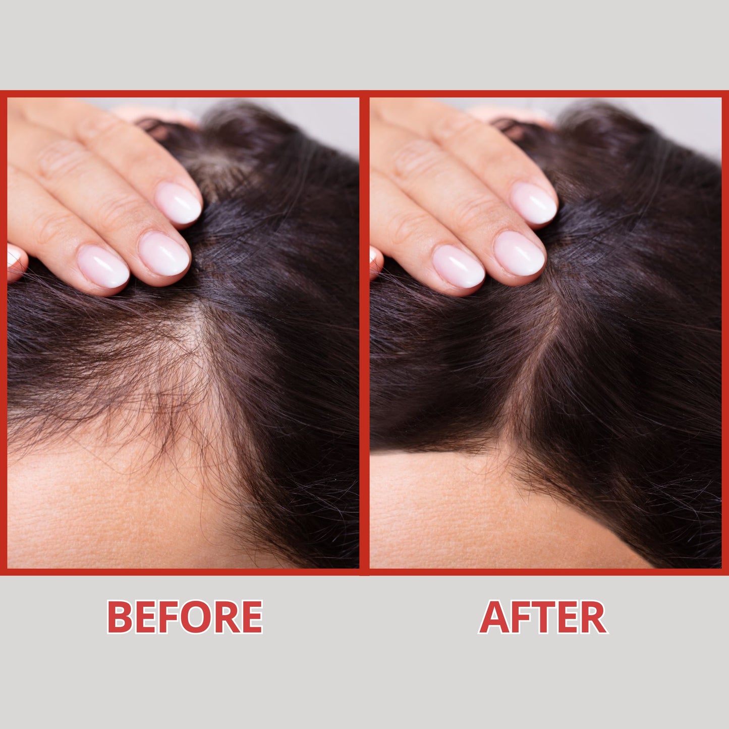 LushCare Hair Growth Serum – Advanced Botanical Regrowth Formula