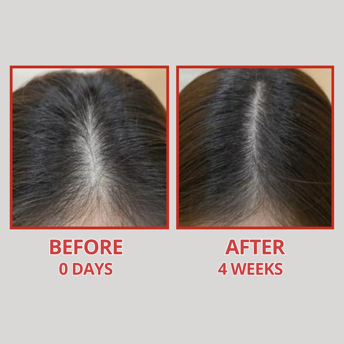 LushCare Hair Growth Serum – Advanced Botanical Regrowth Formula