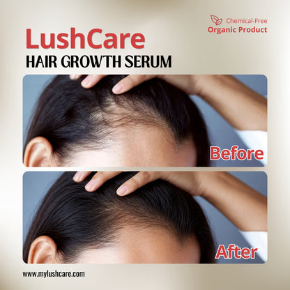 LushCare Hair Growth Serum – Advanced Botanical Regrowth Formula