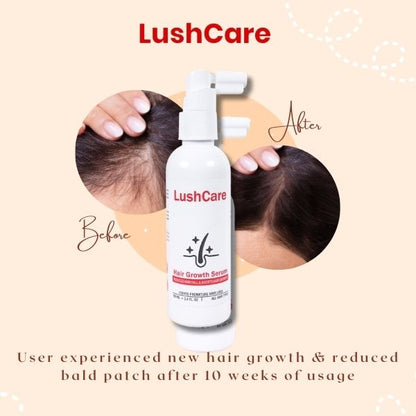 LushCare Hair Growth Serum – Advanced Botanical Regrowth Formula