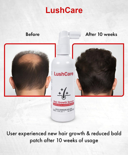 LushCare Hair Growth Serum – Advanced Botanical Regrowth Formula